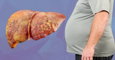 Fatty Liver Symptoms